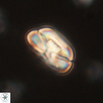 Heliolithus iptamenosdiskos 70501