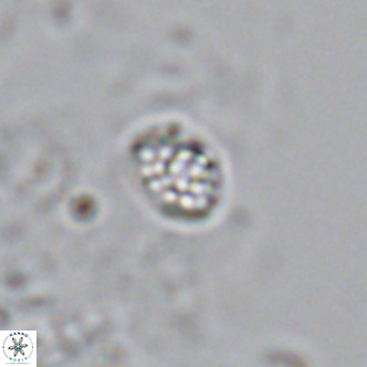 Homozygosphaera schilleri VR 08585