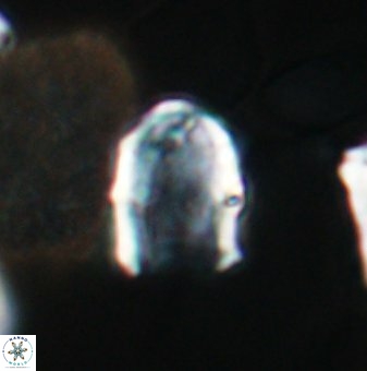 Lapideacassis glans 9445