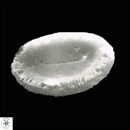 P scutellum 4