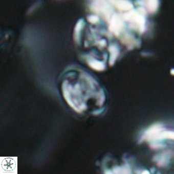 Percivalia hauxtonensis 7962