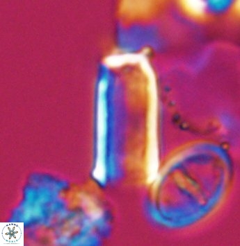 Scampanella bispinosa 9638