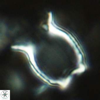 Scyphosphaera amphora VR 07420