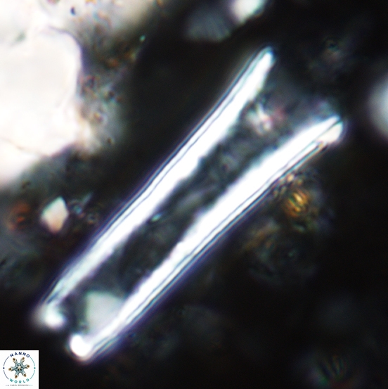 Scyphosphaera decedomurale 1983