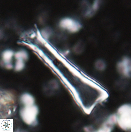 Scyphosphaera quasitubifera 22811