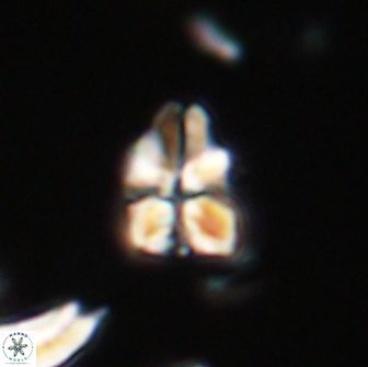 Sphenolithus didymikoryfi 65098