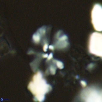 Umbellosphaera tenuis VR 04590