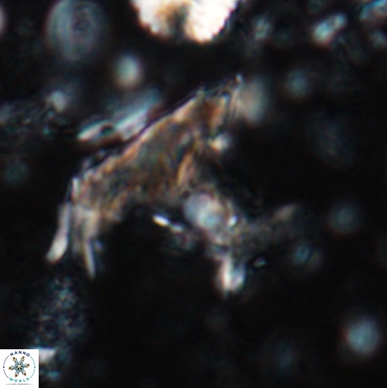 Ceratolithina bicornuta 17587