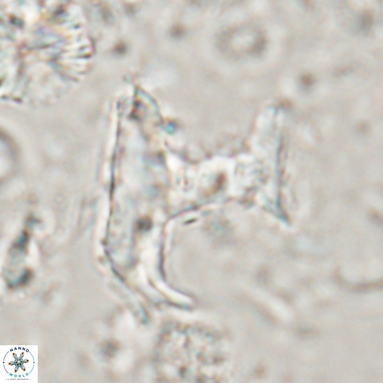 Ceratolithina bicornuta 17589