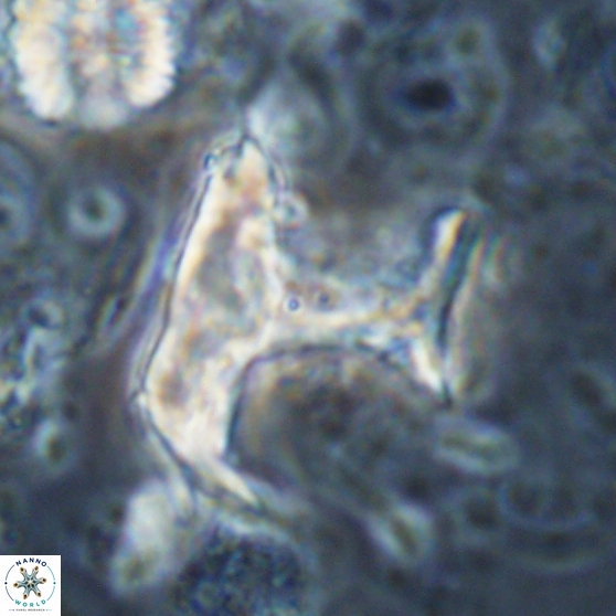 Ceratolithina bicornuta 17594