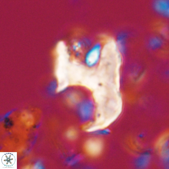 Ceratolithina bicornuta 17596
