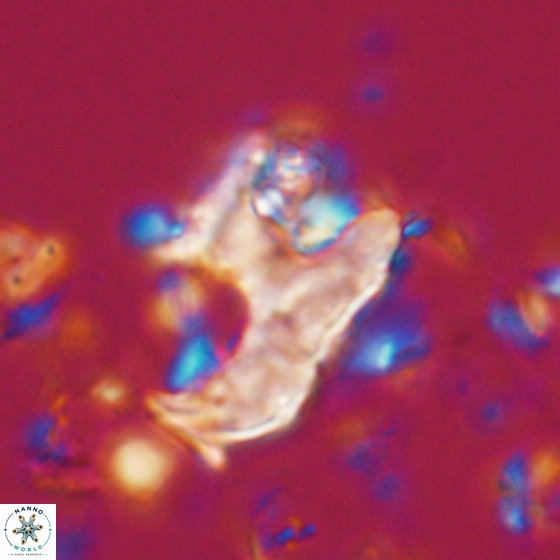 Ceratolithina bicornuta 17598