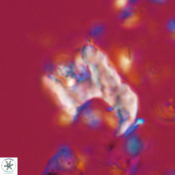 Ceratolithina bicornuta 17600