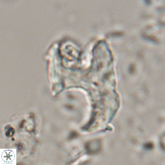 Ceratolithina bicornuta 17601