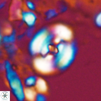 Ellipsagelosphaera supergestus 10974