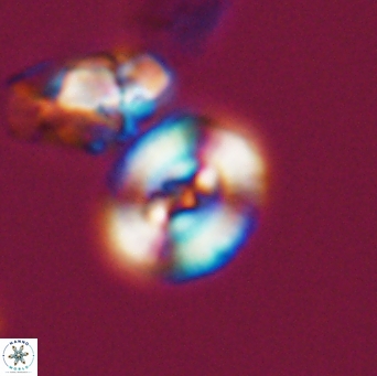 Ellipsagelosphaera supergestus 11027