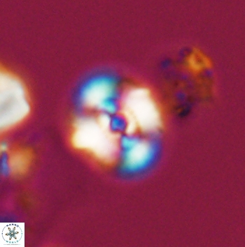 Ellipsagelosphaera supergestus 11172
