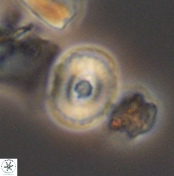 Ellipsagelosphaera supergestus 11177