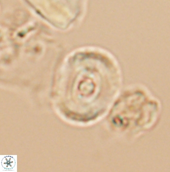 Ellipsagelosphaera supergestus 11178