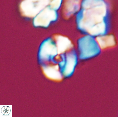 Ellipsagelosphaera supergestus 12610