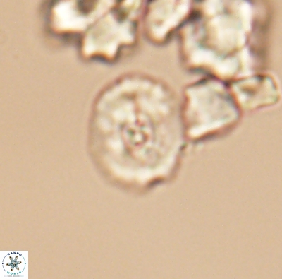 Ellipsagelosphaera supergestus 12611