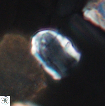 Lapideacassis glans 9441