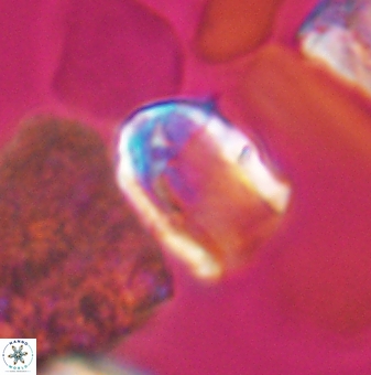 Lapideacassis glans 9442