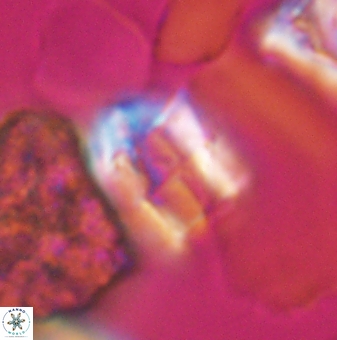 Lapideacassis glans 9443