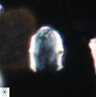 Lapideacassis glans 9445