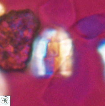 Lapideacassis glans 9447