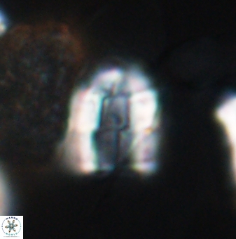 Lapideacassis glans 9448