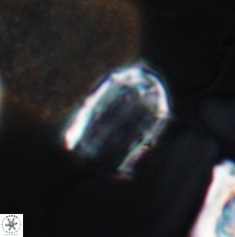 Lapideacassis glans 9449