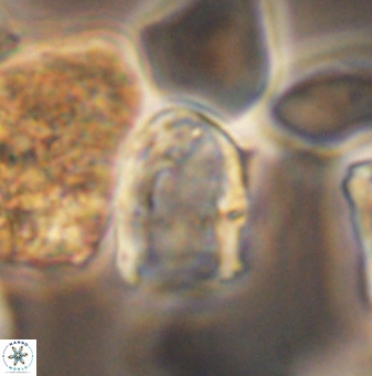 Lapideacassis glans 9451