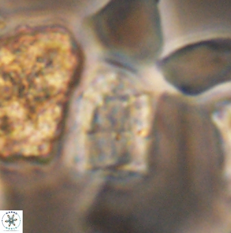 Lapideacassis glans 9452