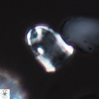 Lapideacassis glans 9282