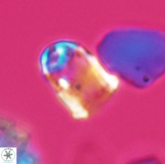 Lapideacassis glans 9283