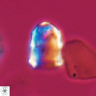 Lapideacassis glans 9284