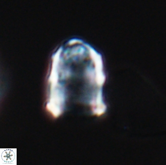 Lapideacassis glans 9285