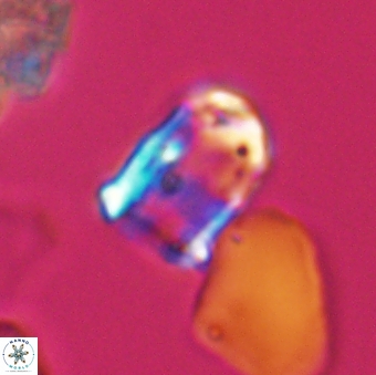Lapideacassis glans 9287