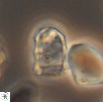 Lapideacassis glans 9288
