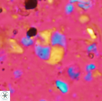 Palaeomicula jacovidesii 5269