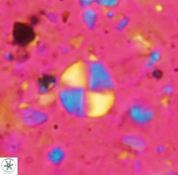 Palaeomicula jacovidesii 5271