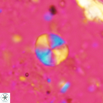 Palaeomicula jacovidesii 5216
