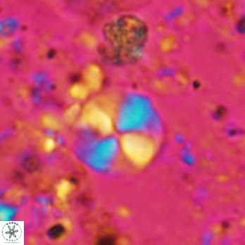 Palaeomicula jacovidesii 5225