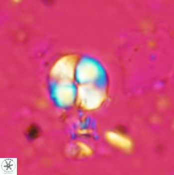 Palaeomicula jacovidesii 5234