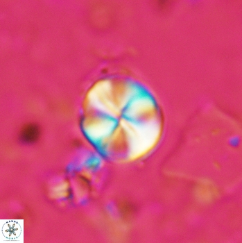 Palaeomicula jacovidesii 5236